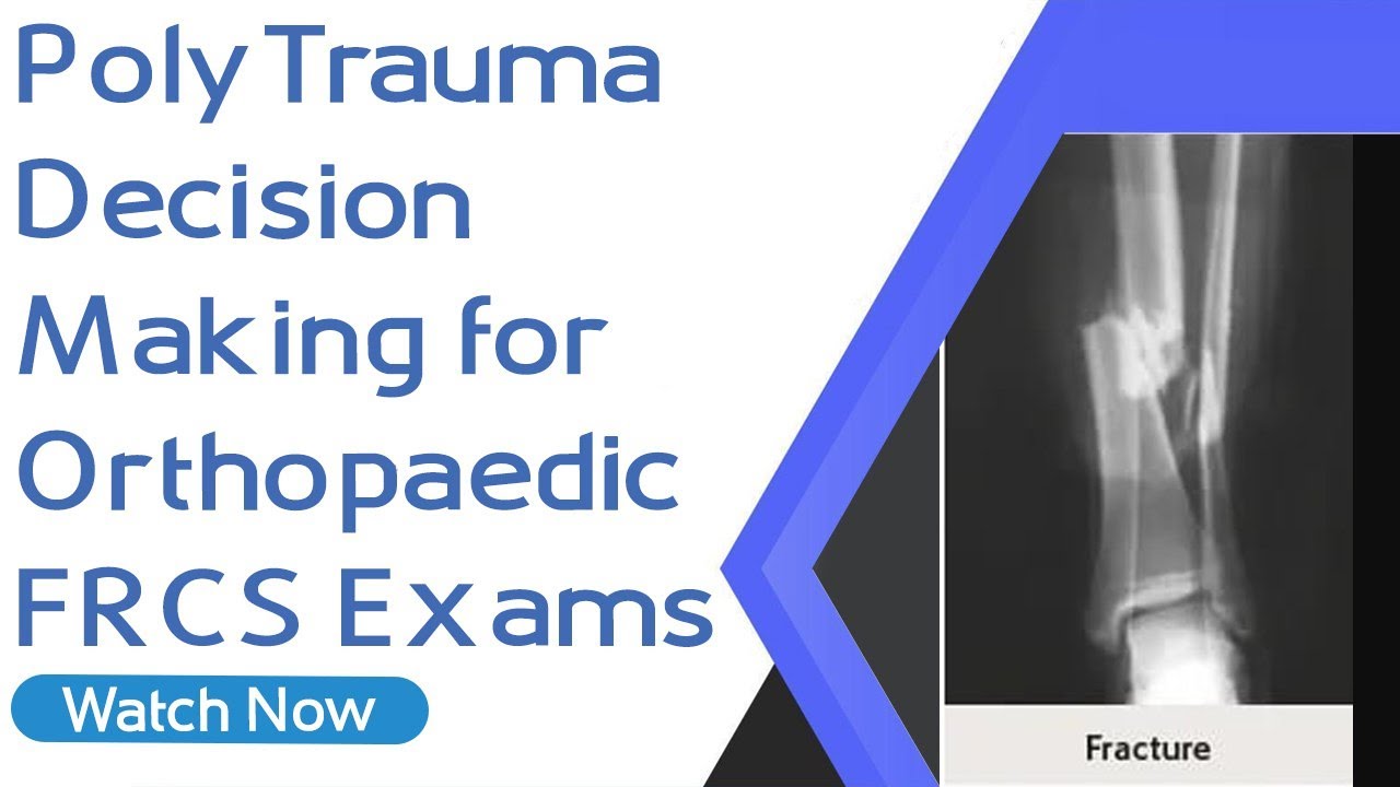 PolyTrauma Decision Making for Orthopaedic FRCS Exams | Orthopaedic Academy
