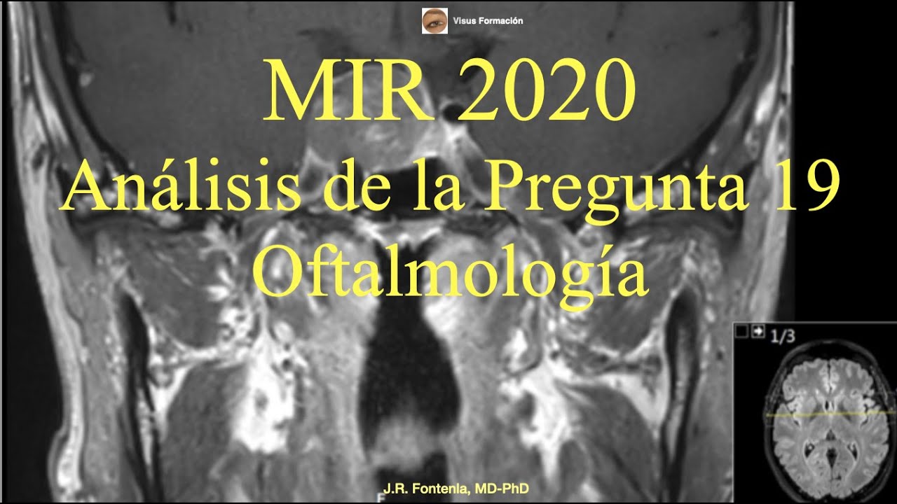 Examen MIR 2020. Oftalmología, Análisis de la Pregunta 19.
