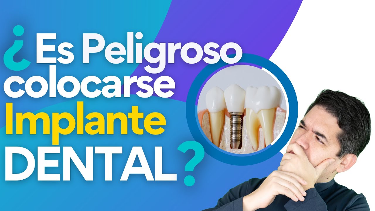 ¿Los Implantes Dentales SON PELIGROSOS? 😟😵