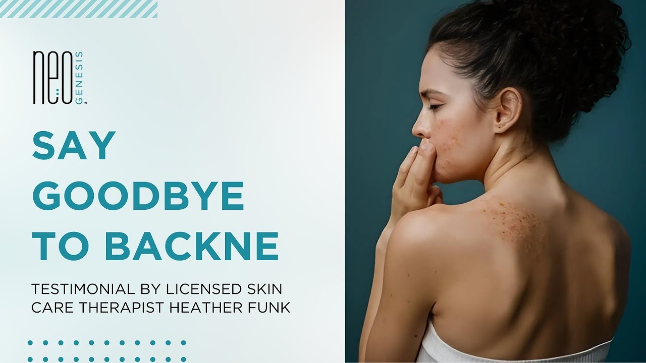 Say Goodbye to Backne: Testimonial by Licensed Skin Care Therapist Heather Funk