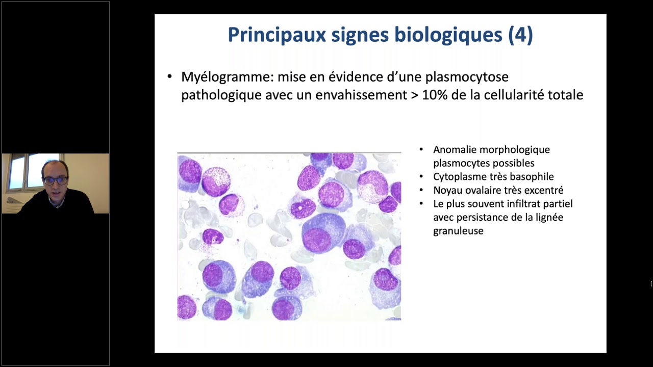 Phase Socle : Myélome multiple
