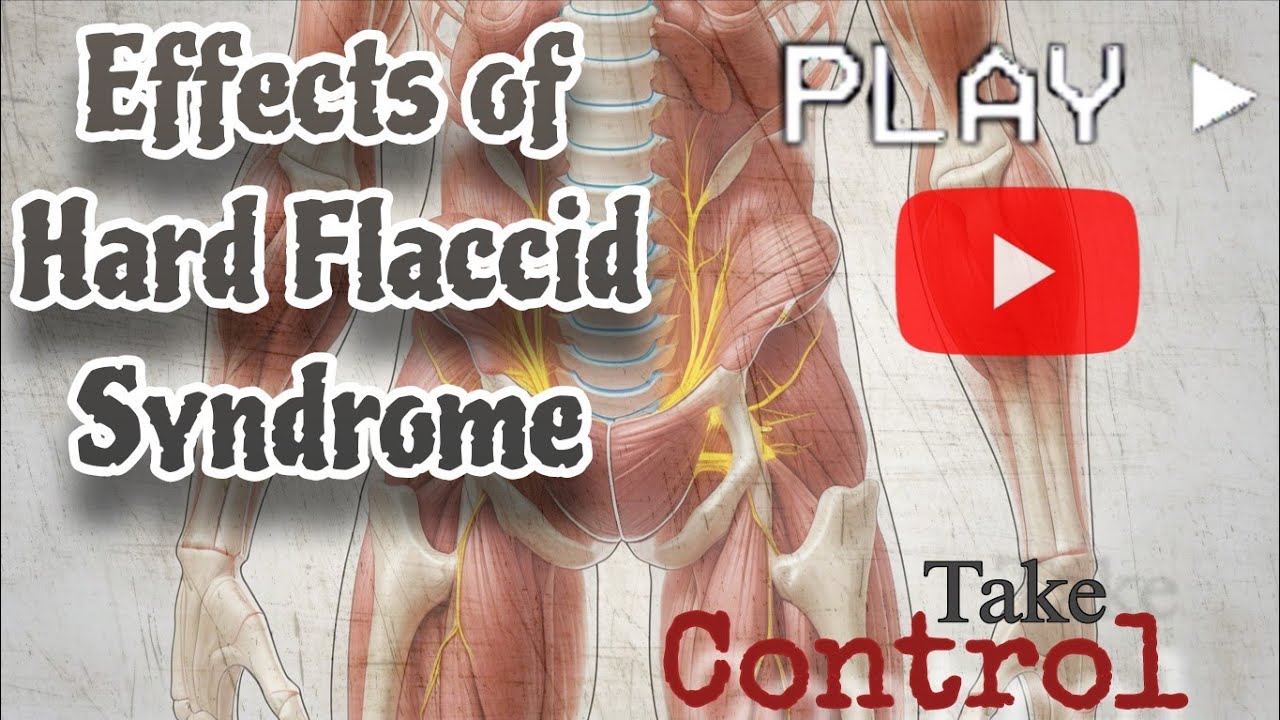 Hard Flaccid Syndrome: Explanation and Effects of HFS  (Take Control Now !)