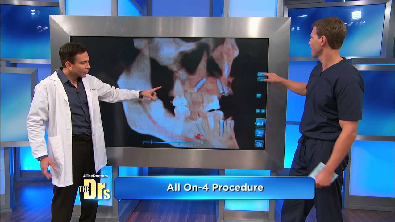 Dental Makeover Surprise