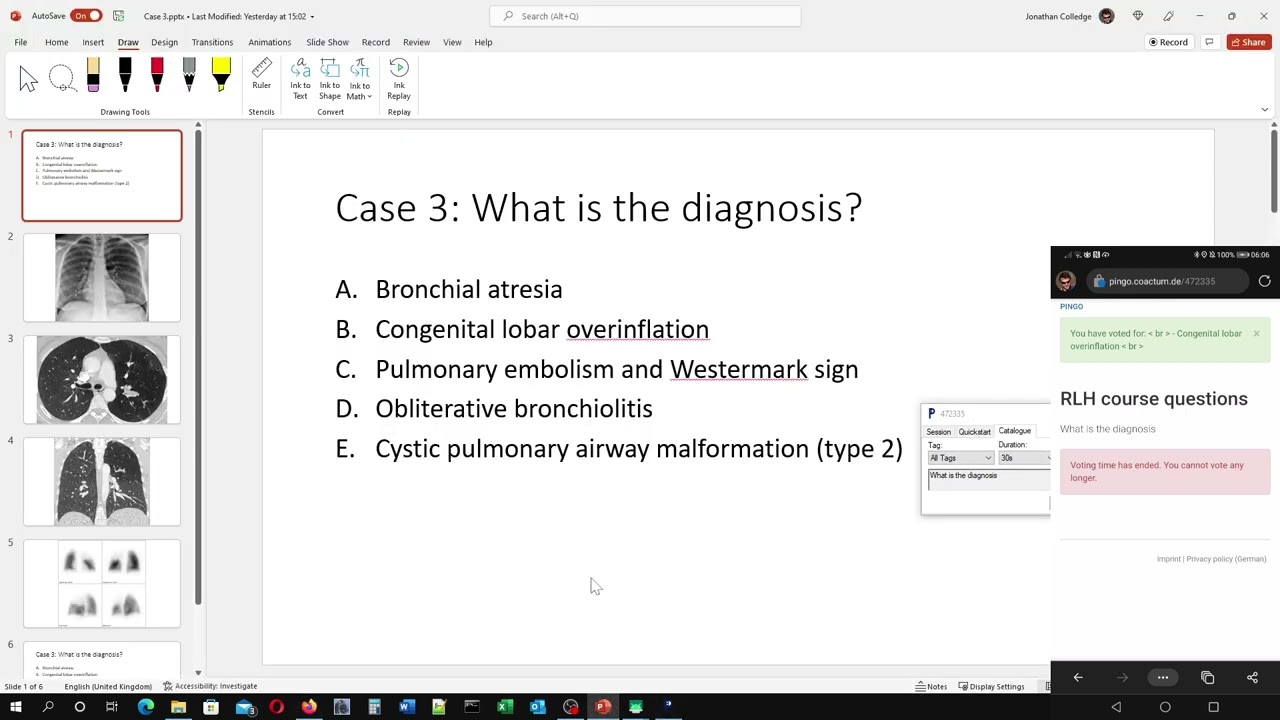 Creating live polls/questions in PowerPoint
