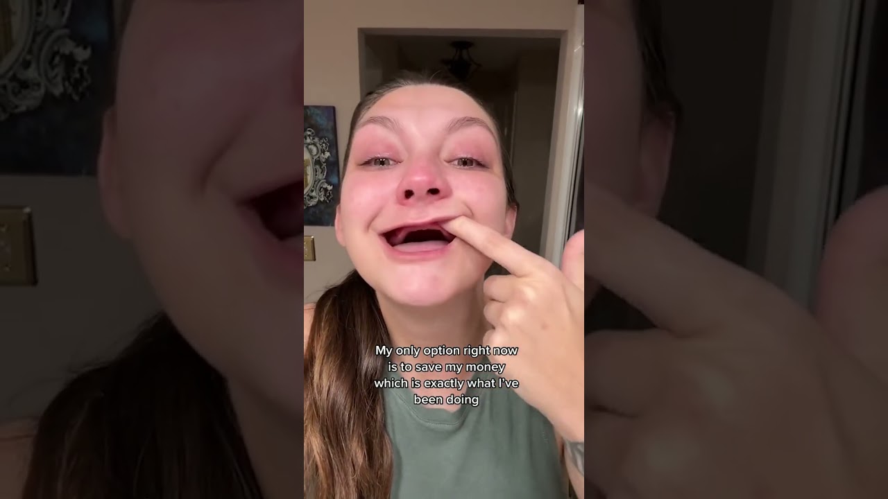 Young Woman Has Dentures