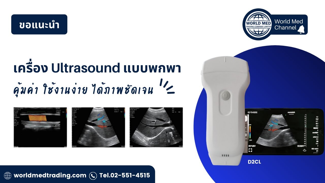 เครื่องอัตราซาวด์ ชนิดมือถือ Handheld Ultrasound