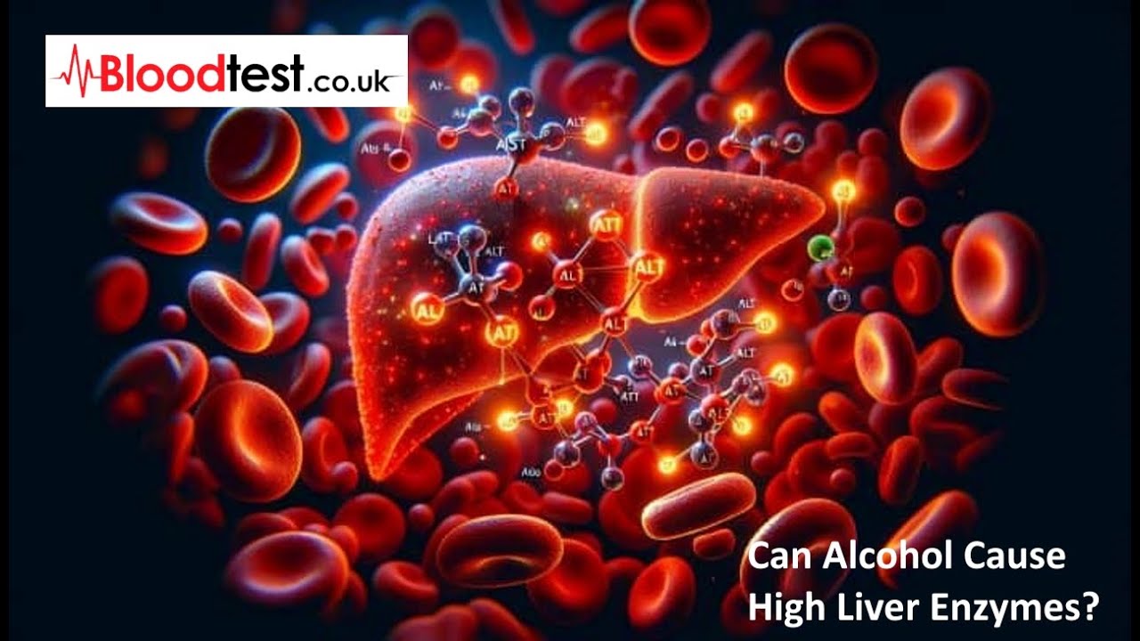 Can Alcohol Cause High Liver Enzymes