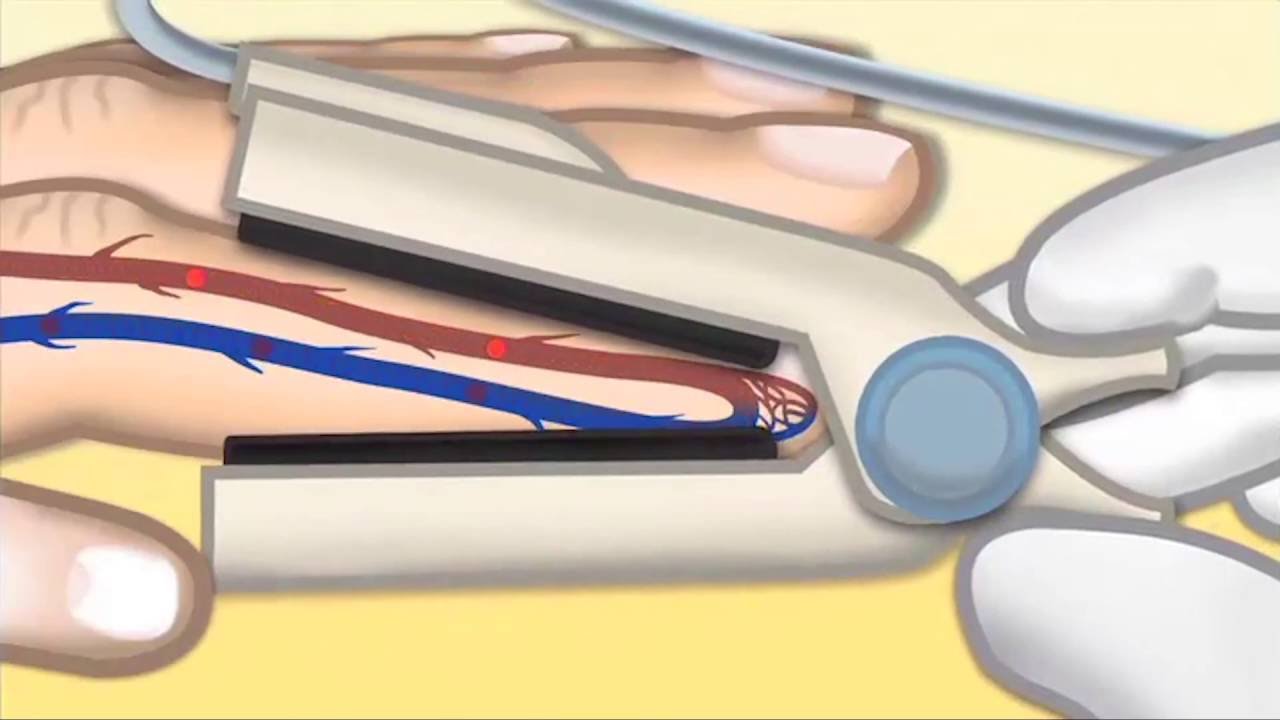 Pulse Oximetry by T. Wolbrink | OPENPediatrics