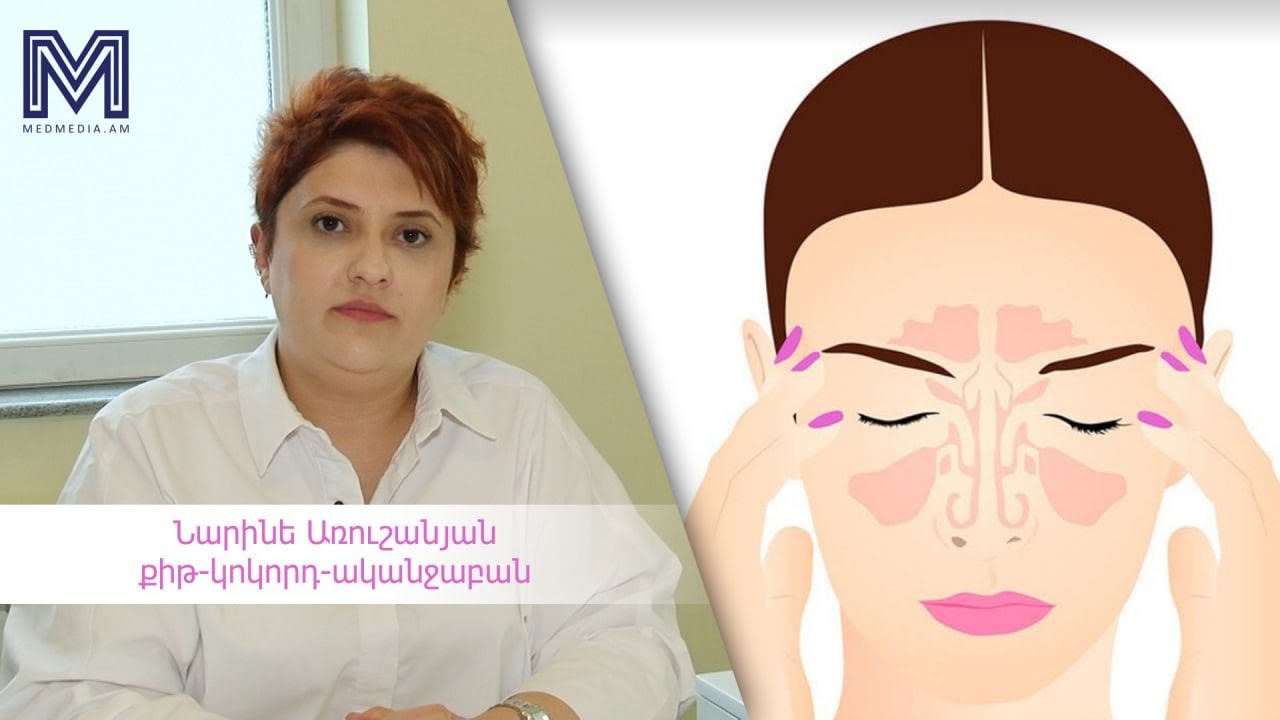 Երեք խորհուրդ բժշկից․հայմորիտ