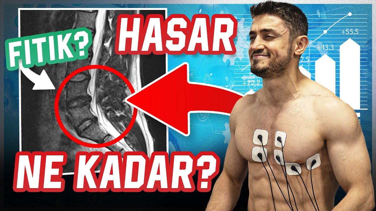 Check-Up Yaptırdık: Spor Ne Kadar Zararlı?