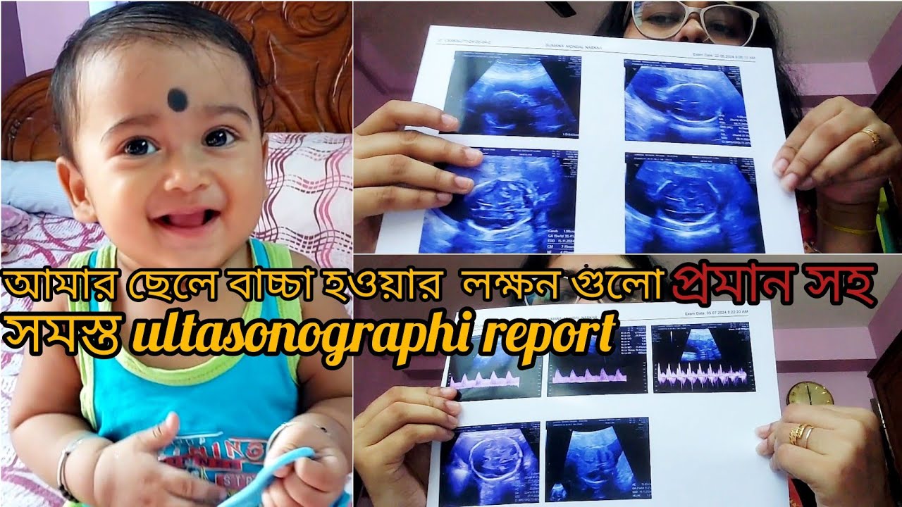 ছেলে বাচ্চা হওয়ার যে লক্ষন গুলি প্রমাণ সহ আমার সমস্ত report share করলাম। ।