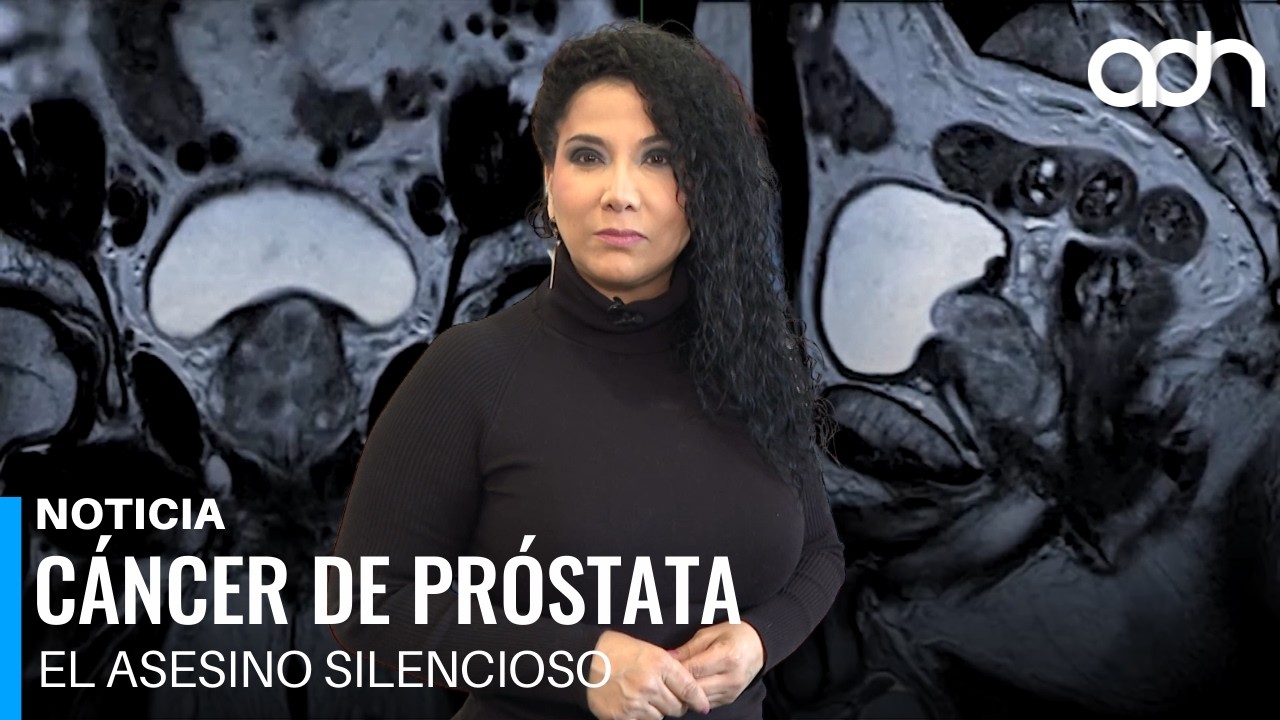 Cáncer de próstata, el asesino silencioso | Sex Pópuli