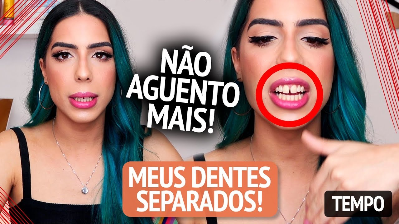 PQ EU NÃO CONSERTO MEU DENTE SEPARADO?!