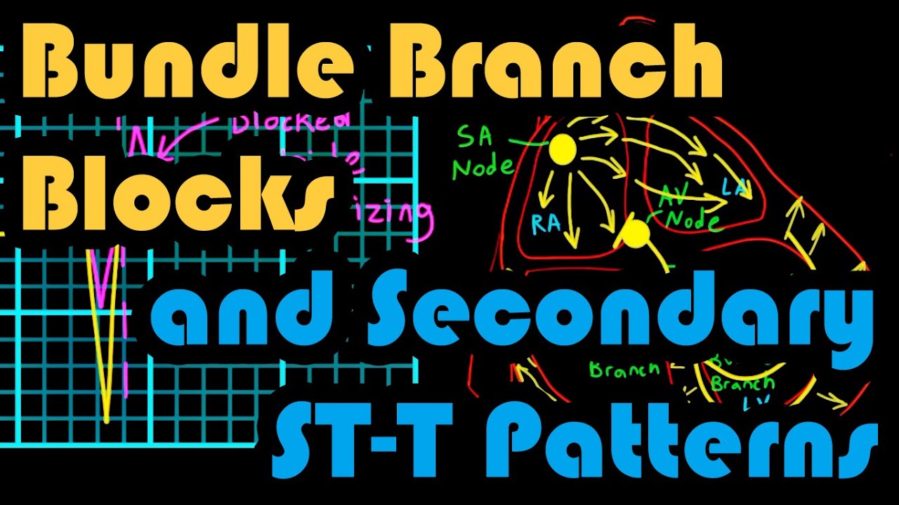Bundle Branch Blocks and Secondary ST-T Patterns: How to Read an EKG Curriculum