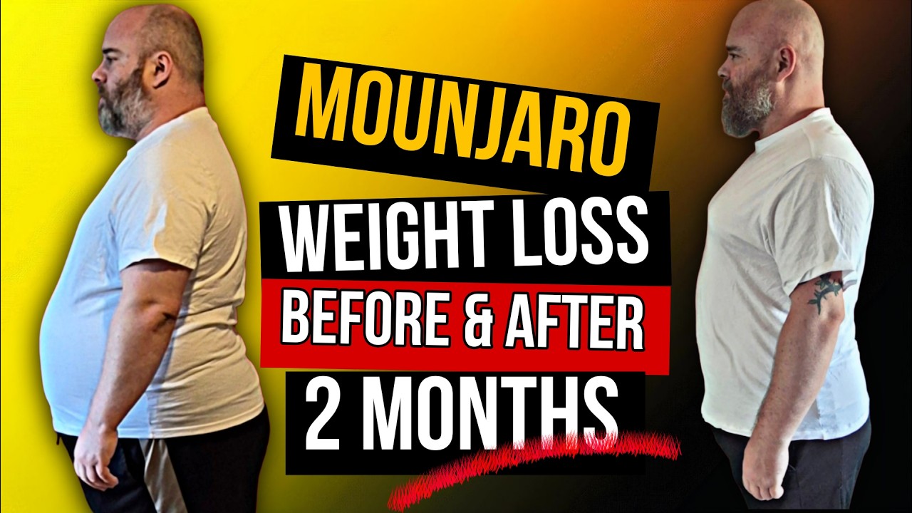 Mounjaro Weight Loss: BEFORE and AFTER - 2 Months Later