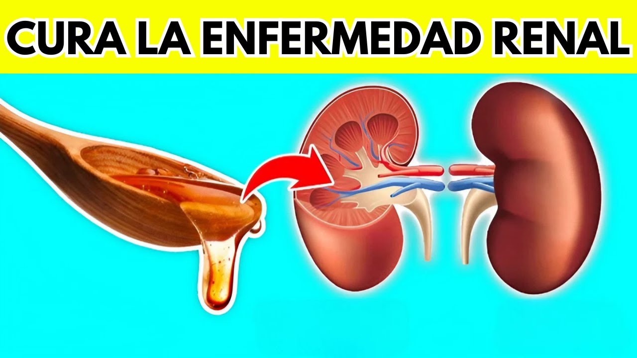 NINGÚN paciente renal volverá a perder un riñón, Mira Esto