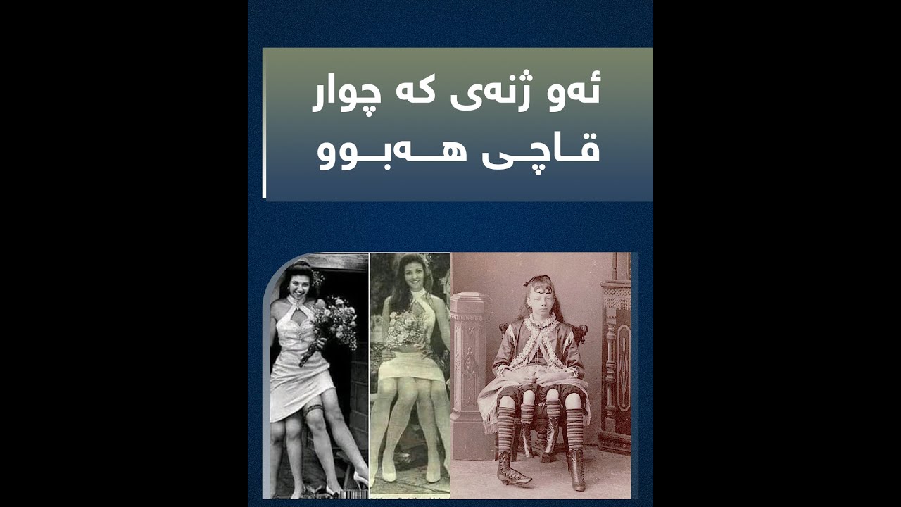 جۆزفێن مێرتل ئەو ژنه‌ی كه‌ چوار قاچی هه‌بوو