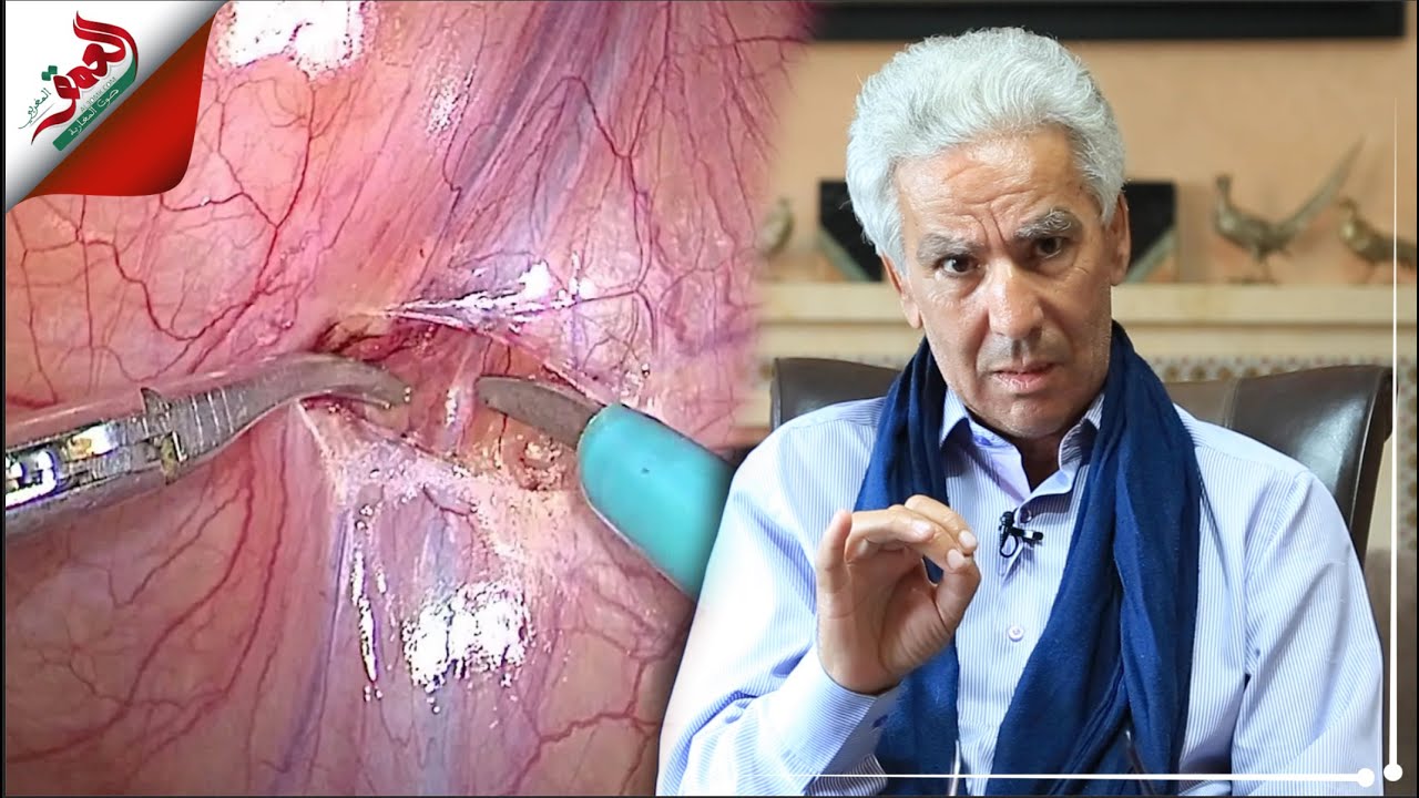 دوالي الخصية: أسباب وأعراض وعلاج العقم عند الرجال
