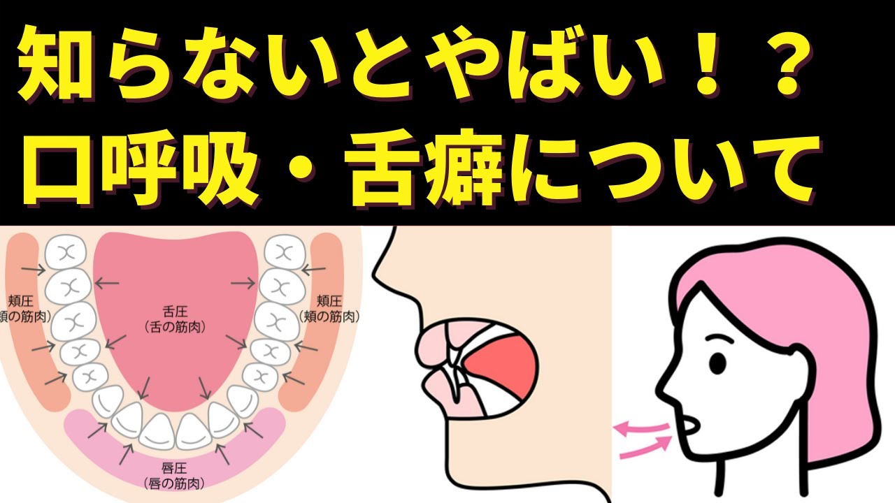 【口呼吸・舌の癖は治すべき！】歯列矯正・歯並びからデメリットを矯正歯科医が解説