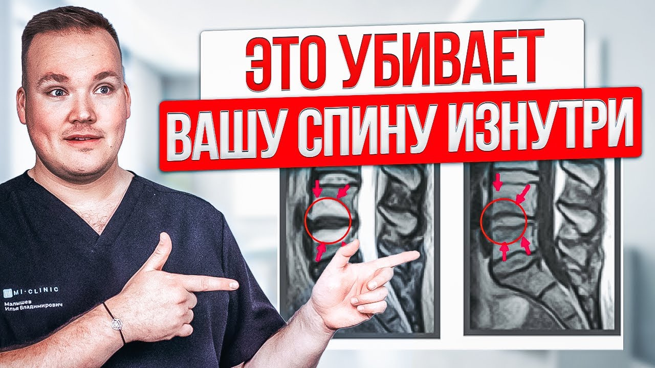 Как вылечить ХРОНИЧЕСКУЮ БОЛЬ в спине. Почему  лечение МОДИК не работает