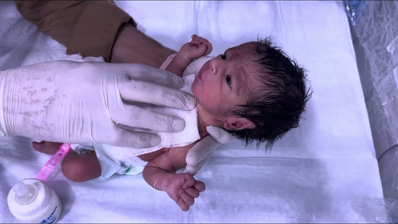 29 Week Premature Baby Condition Improved Now Feeding Well NICU Progress Update 👶