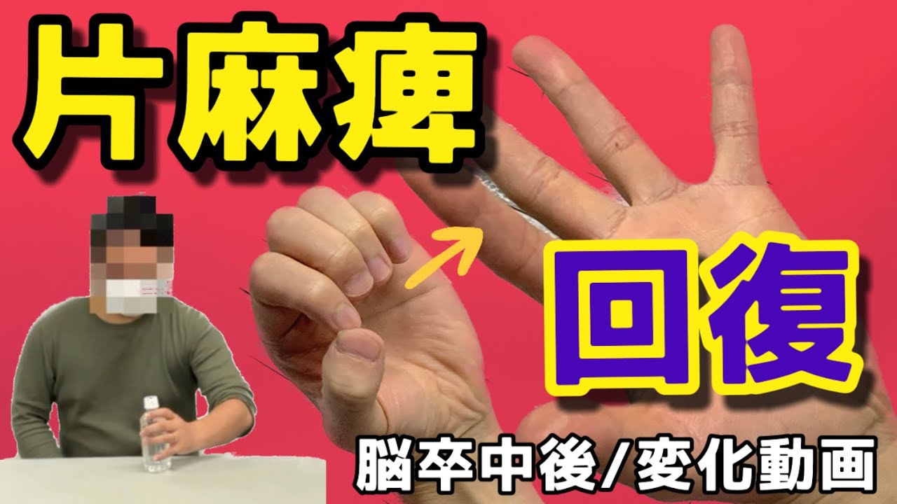 「手の自由を戻す！お椀が持てるまでの道筋。脳卒中/片麻痺からの回復」