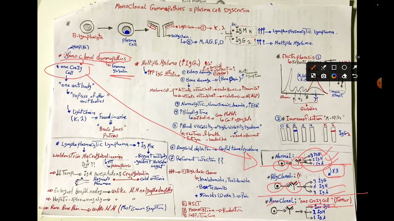 Plasma cell disorders( Multiple Myeloma, lympho-plasmacytic lymphoma)