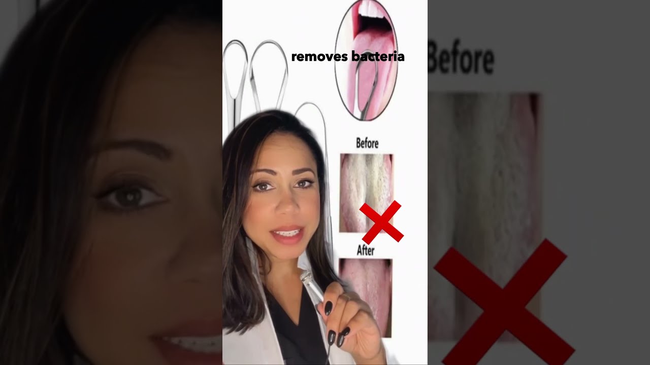 How to STOP Bad Breath in Kids 🤮 at the Source! Pediatric Dentist Tips