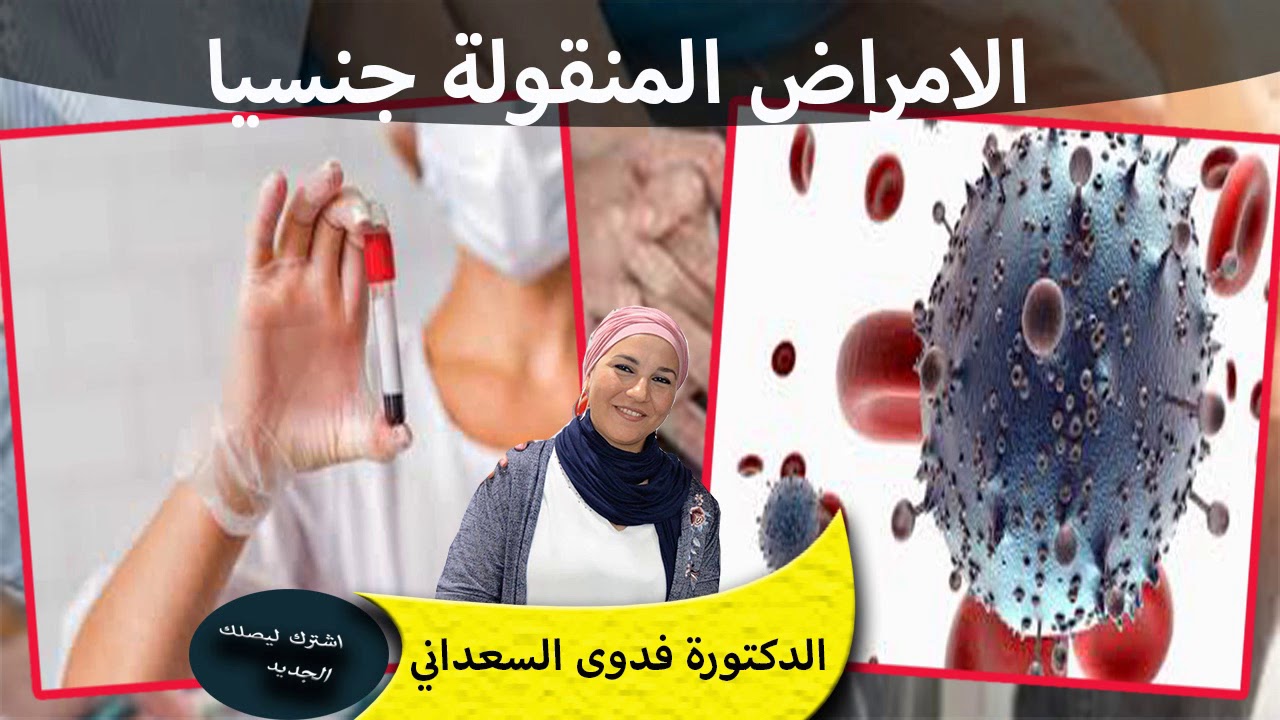 الامراض المنقولة جنسيا ماهي انواعها وكيف نتعامل معها الدكتورة فدوى السعداني