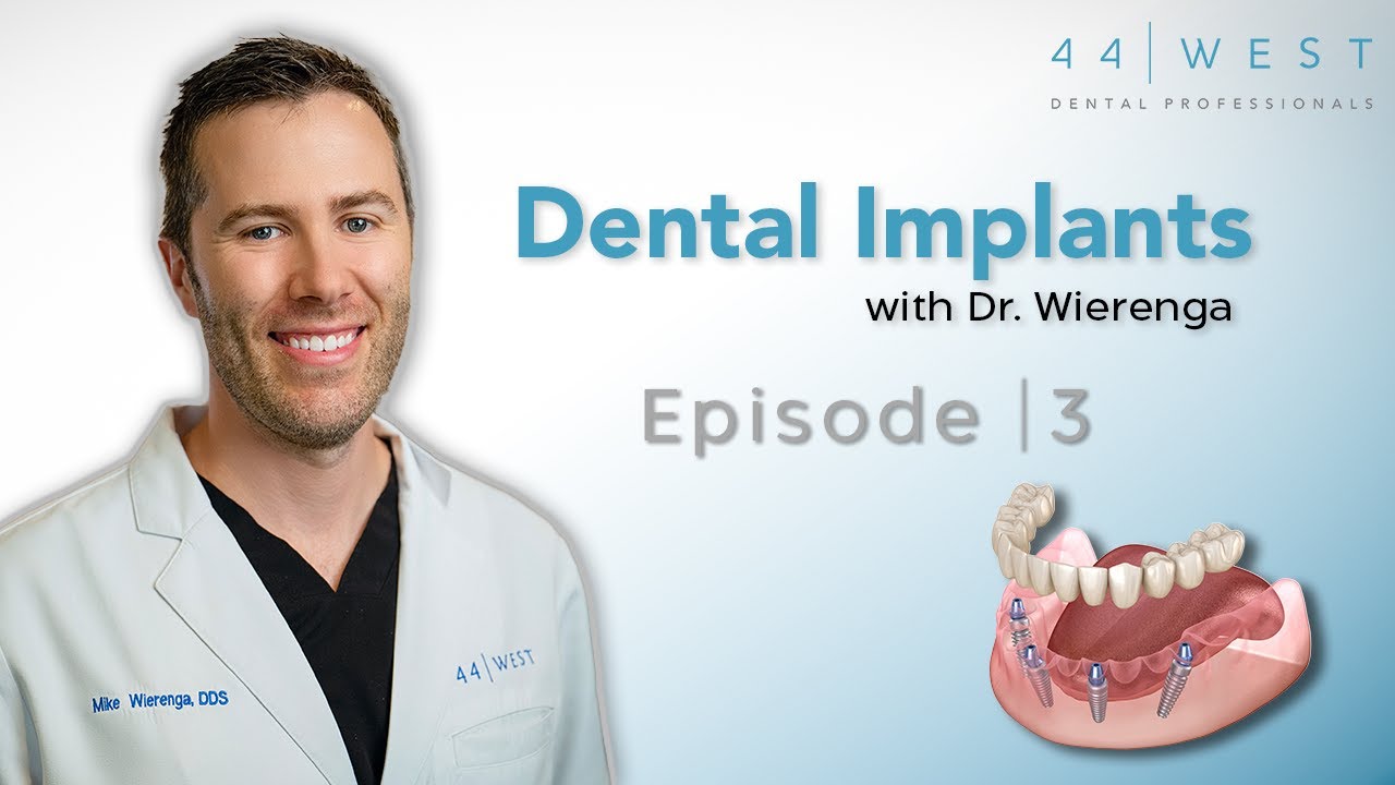 What Is All-On-4? | Dental Implants with Dr. Wierenga