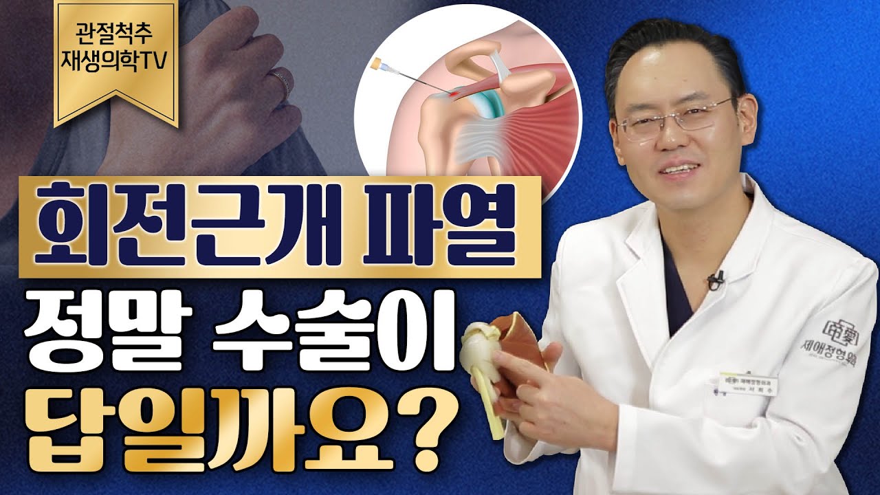 회전근개파열, 정말 수술이 답일까요? @제애정형외과 어깨관절명의 서희수 원장 (#회전근개파열 #회전근개파열수술 #어깨회전근개파열 #어깨명의 #어깨관절명의 #어깨통증치료)