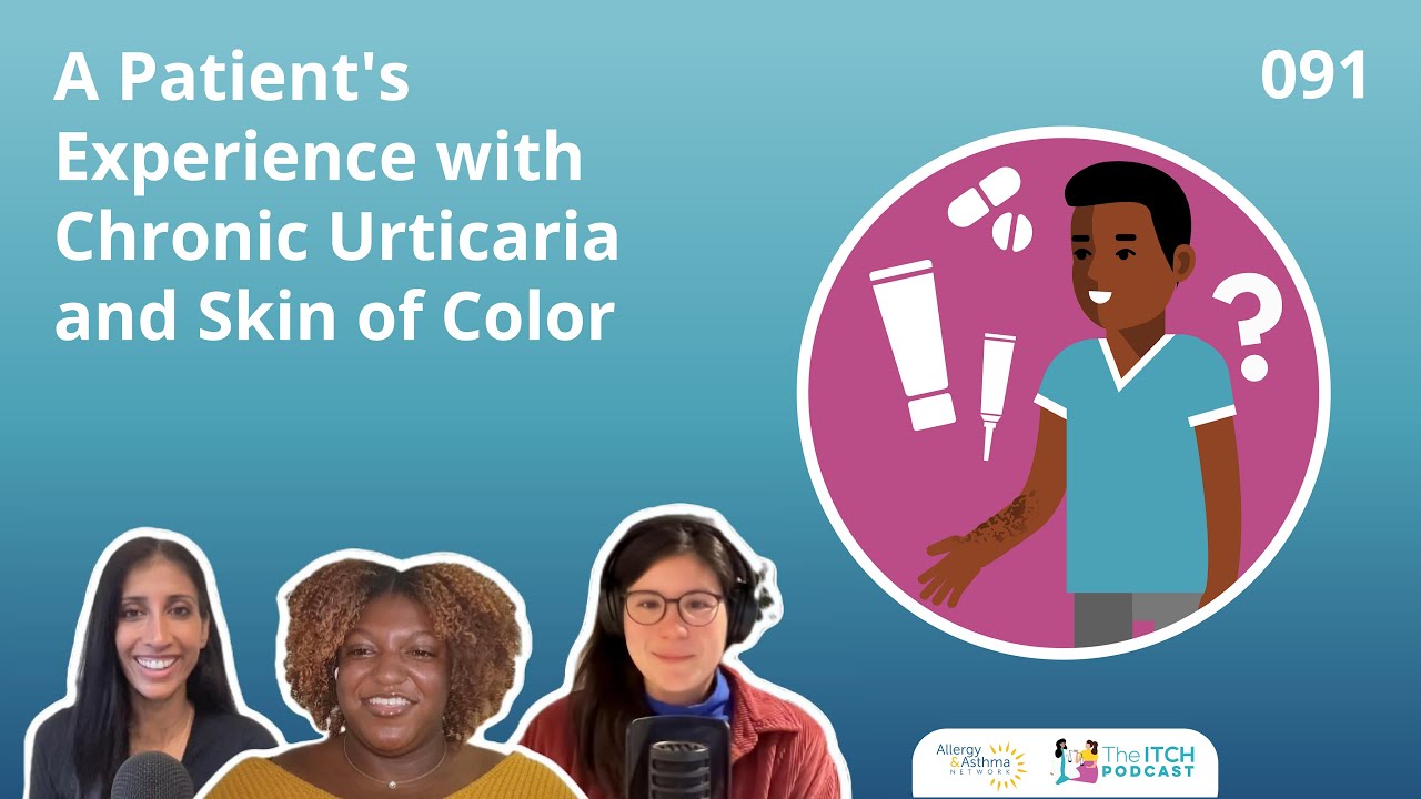 Living with Chronic Urticaria in Skin of Color | Meka's Story