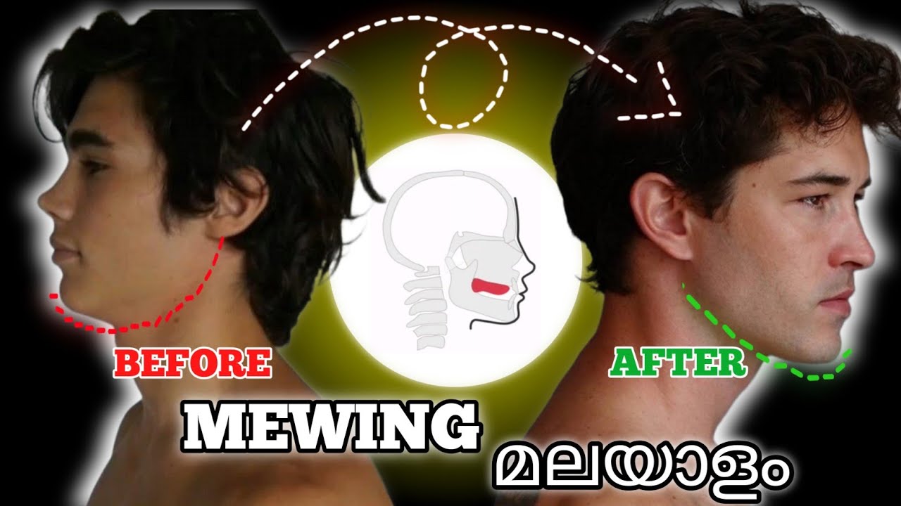 Mewing എങ്ങനെ proper ആയി ചെയ്യാം