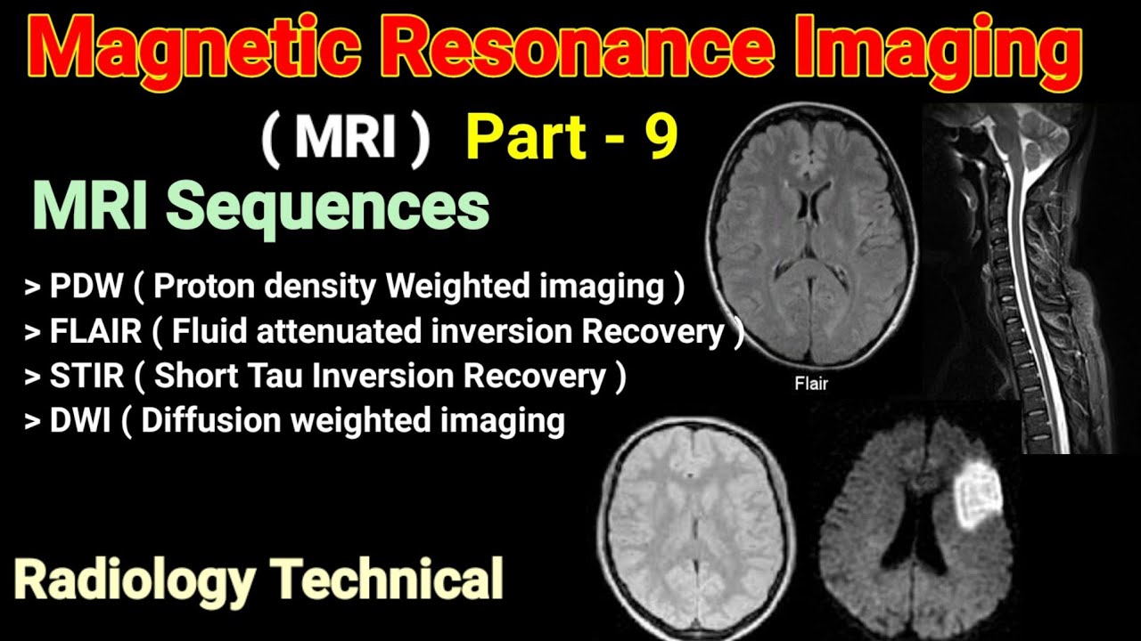 MRI # Part - 9 # MRI Sequences # PDW # FLAIR # STIR # DWI Sequences #  In Hindi || By BL Kumawat  #