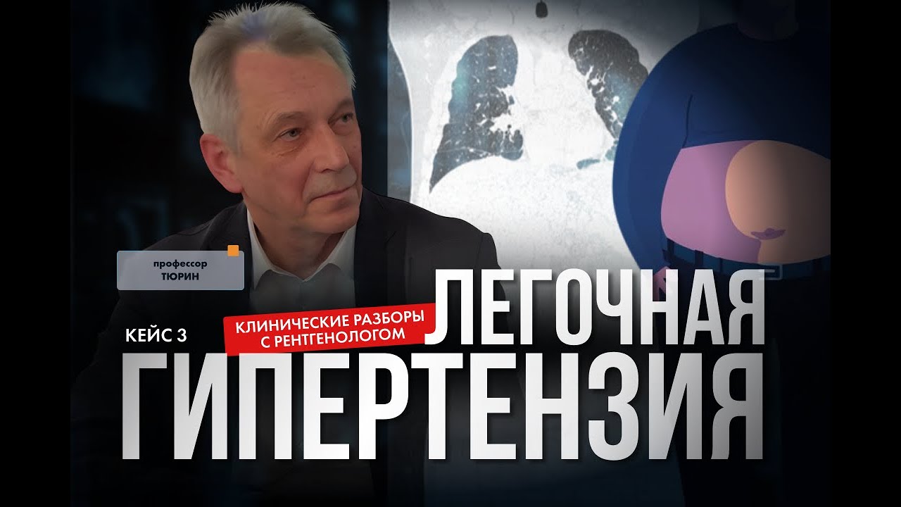 Клинические разборы с рентгенологом. Легочная гипертензия