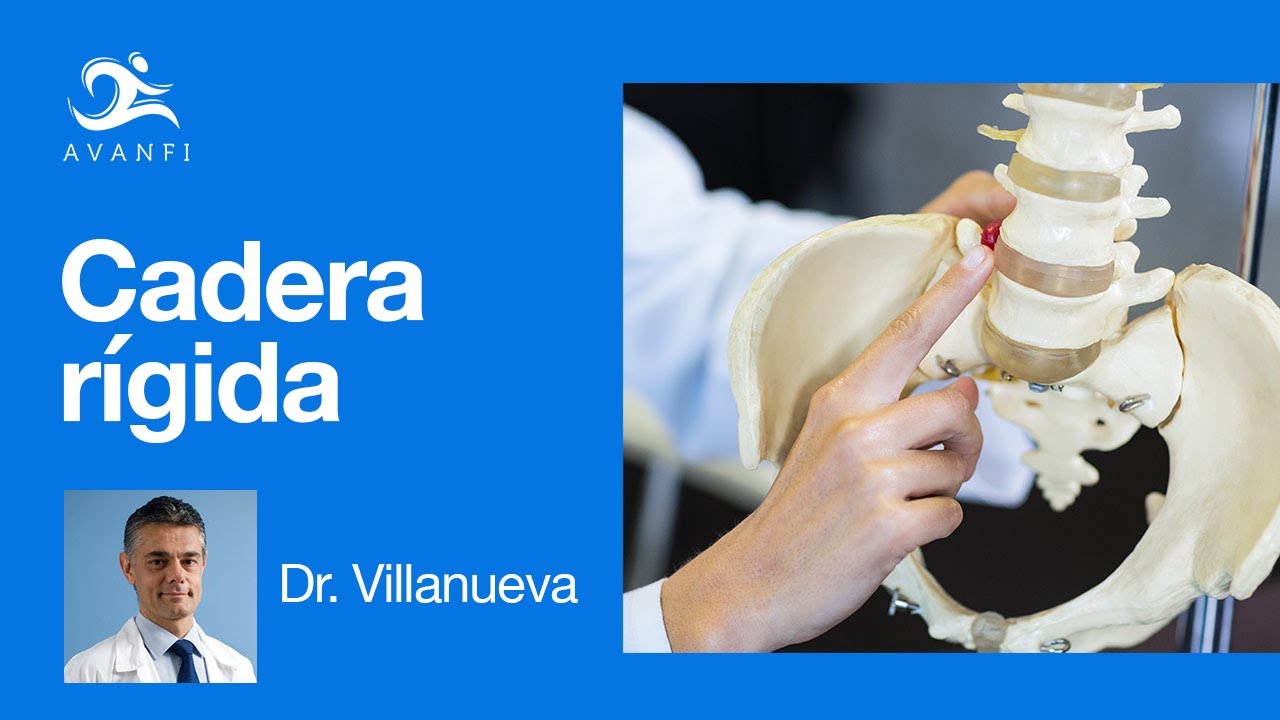 &iquest;Qu&eacute; es y c&oacute;mo se trata la Cadera R&iacute;gida? Doctor Villanueva