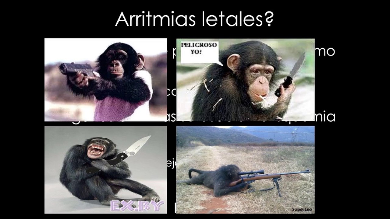 Arritmias, enfrentamiento de urgencia #FOAMed #MUE #ChileEM