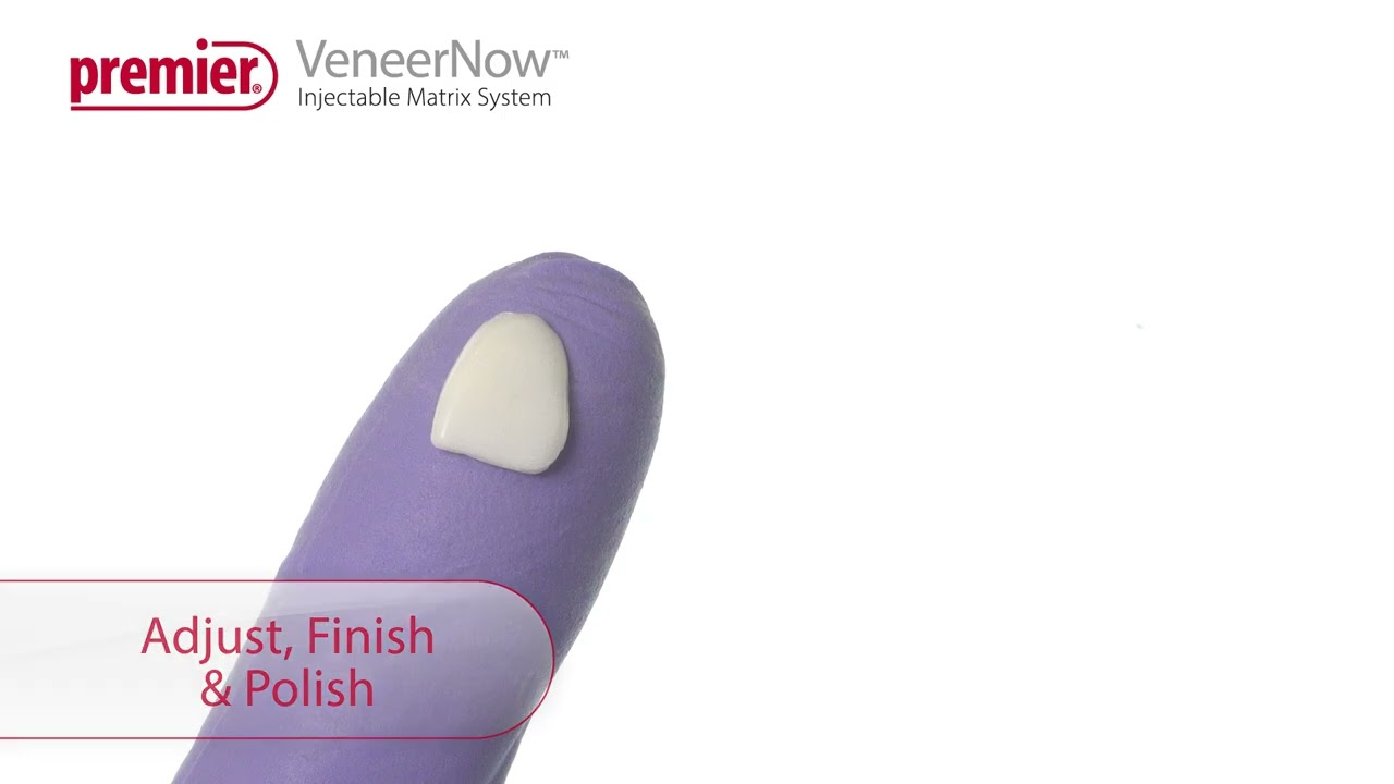 VeneerNow™ Injectable Matrix System - Fabrication of a Semi-direct Veneer Using Packable Composite
