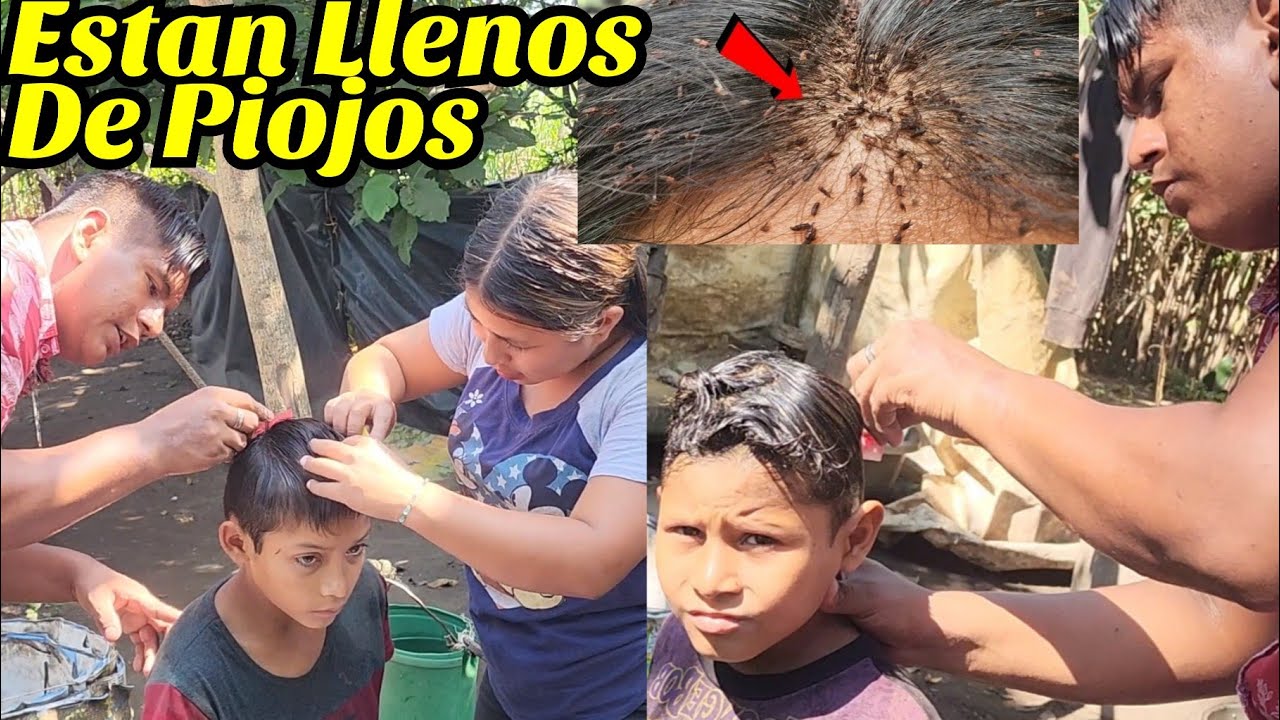 Sacamos Todos Los Piojos Que Tenian😬Estos Niños Estaban Llenos De Piojos Y Otras Cosas