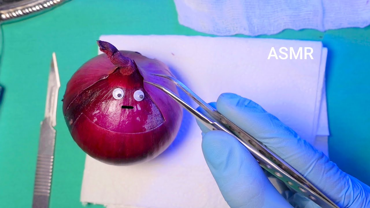 ASMR Onion Debridement Surgery | Removing Infected Tissue