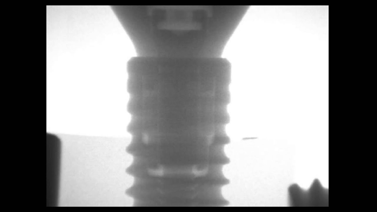 Zipprich   Micro Movements on Implant Abutment Interfaces part 2
