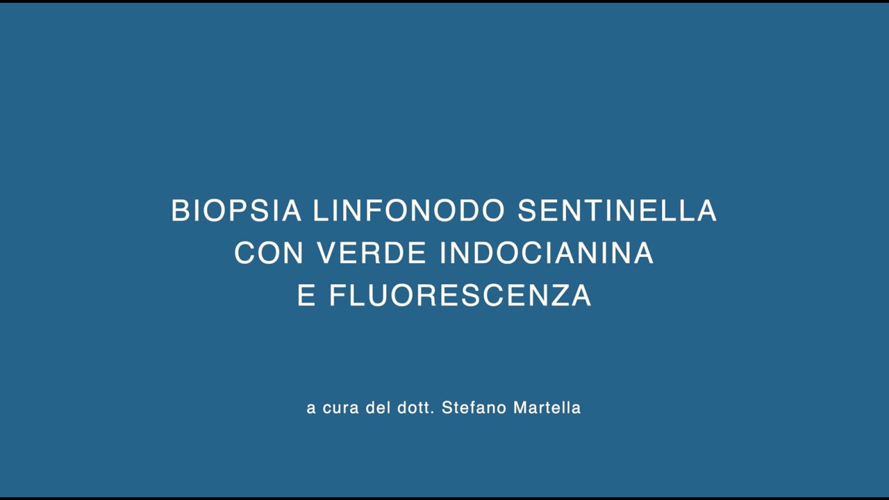 Linfonodo Sentinella