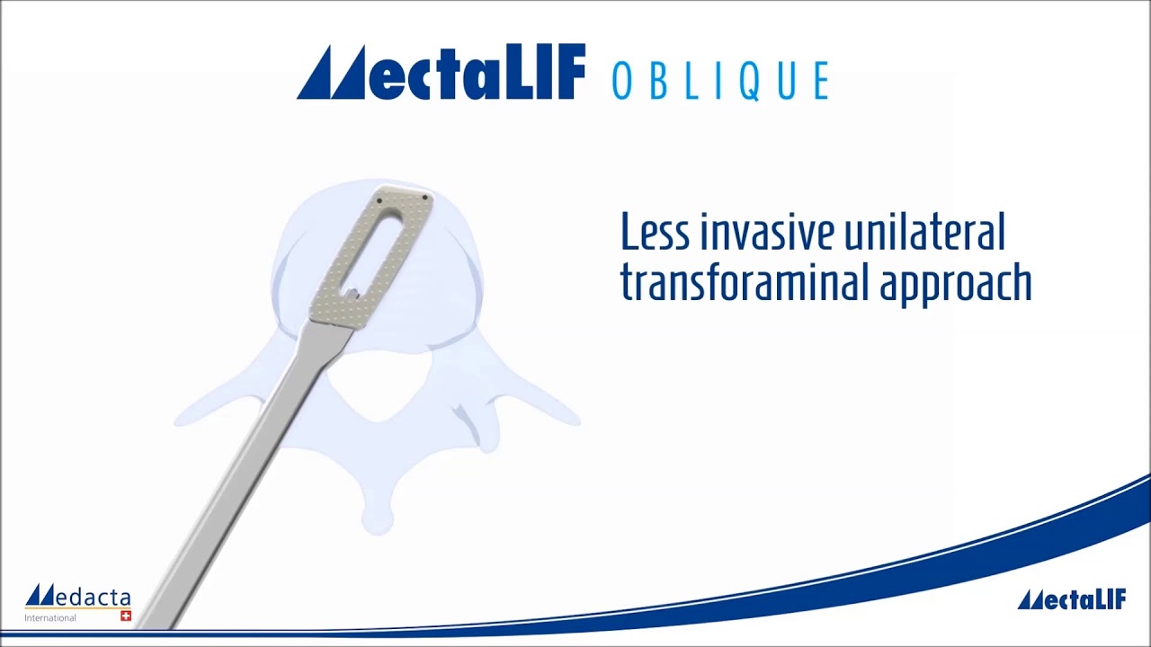 Medacta: MectaLIF Oblique Posterior
