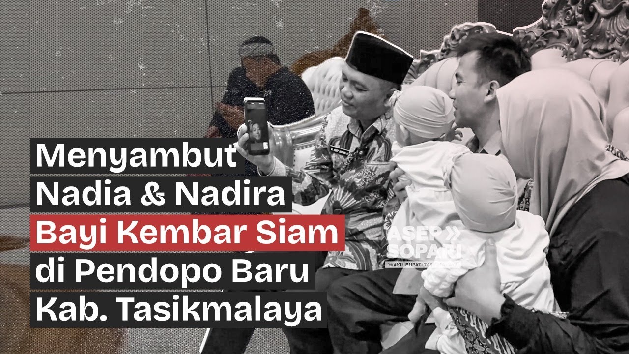BAYI KEMBAR SIAM YANG SUDAH BERHASIL DIPISAH DISAMBUT KANG ASEP DI PENDOPO BARU TASIKMALAYA!!!