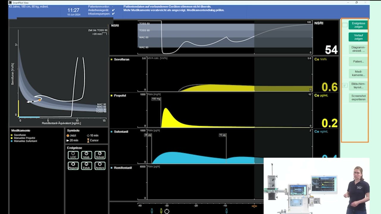 SmartPilot View Training – Bildschirm & Ansichten