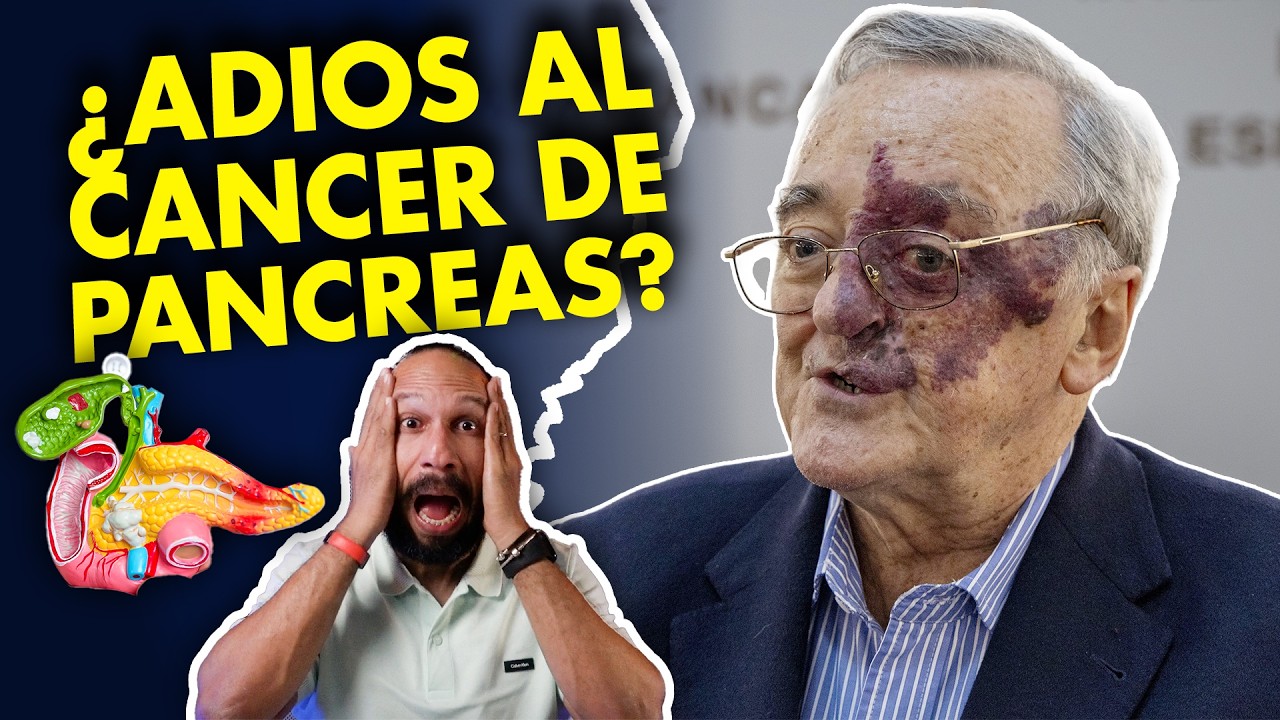 👨🏾‍⚕️  ¿Se curó el cáncer de páncreas en España? La verdad detrás del anuncio
