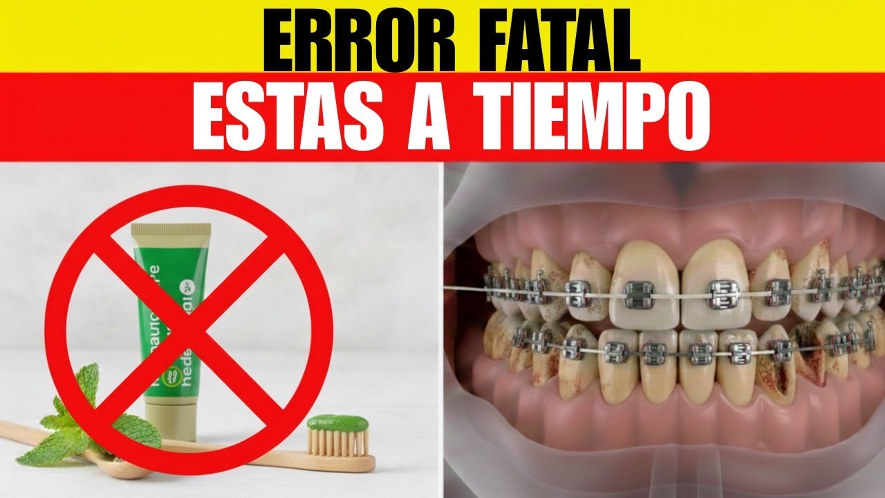 🚨ALERTA: 7 Hábitos Diarios Que Dañan tus Dientes