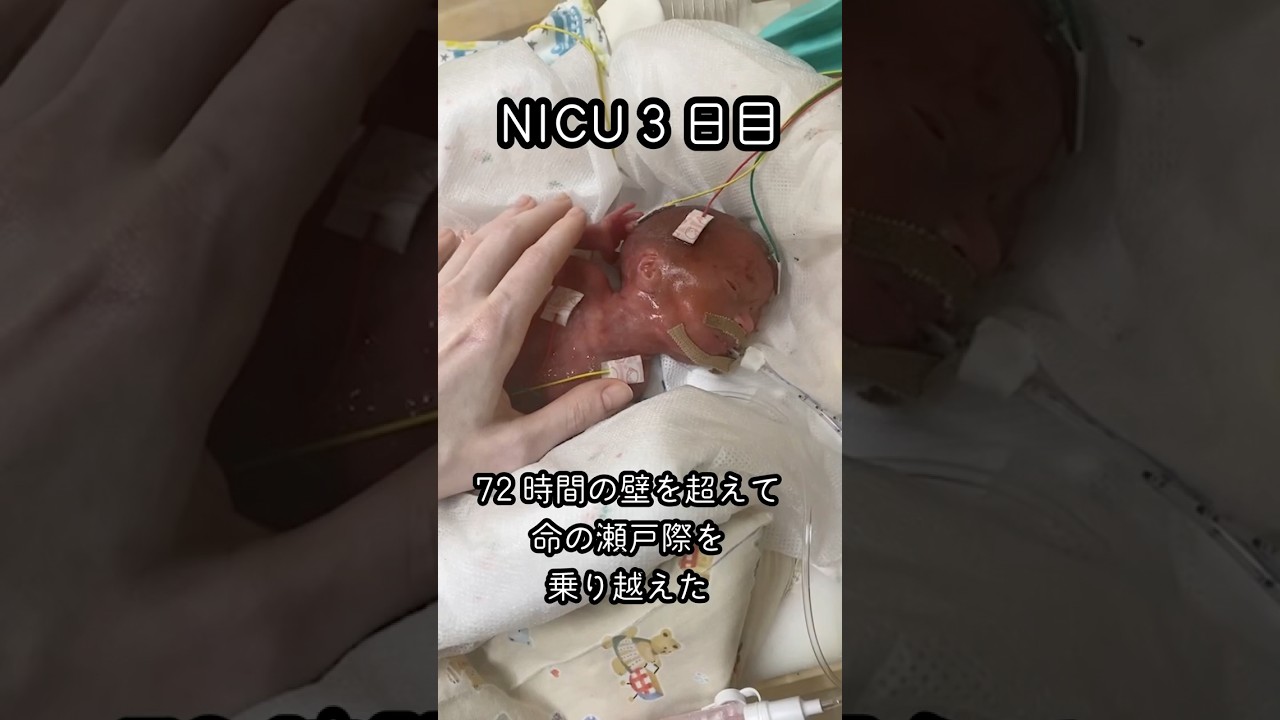 【NICU 3日目】「生きられないかもしれない」そんな不安を超えて | 未熟児の娘が72時間の壁を乗り切った #nicu #赤ちゃん #未熟児