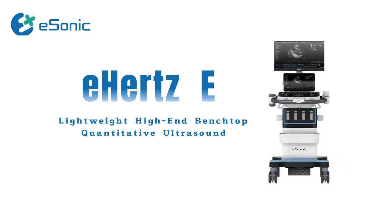 eHertz E: Redefining Premium Whole-Body Ultrasound Diagnostics