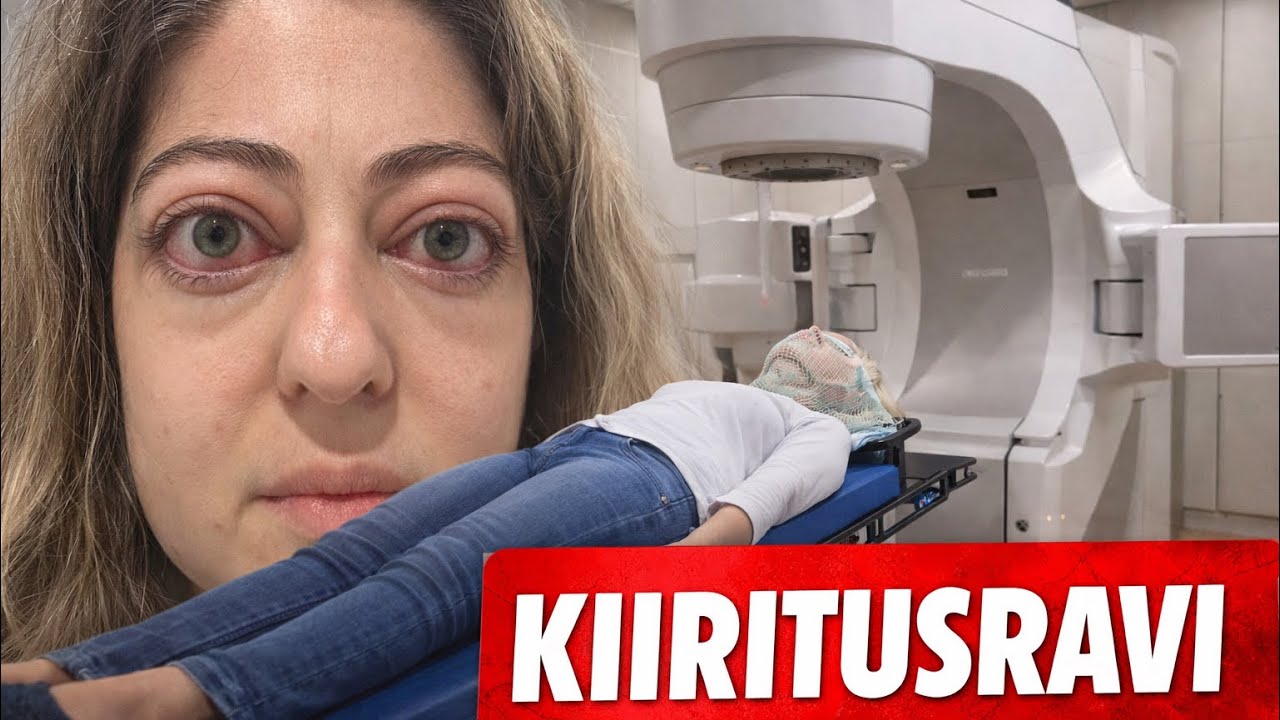 Lõpuks ometi ravi Graves’i tõvele | Esimene kiiritusnädal / OSA 1